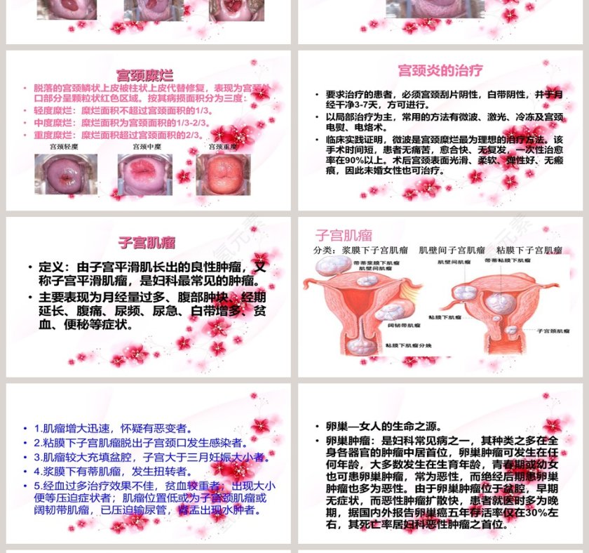 简约清新妇科健康知识讲座PPT模板第4张