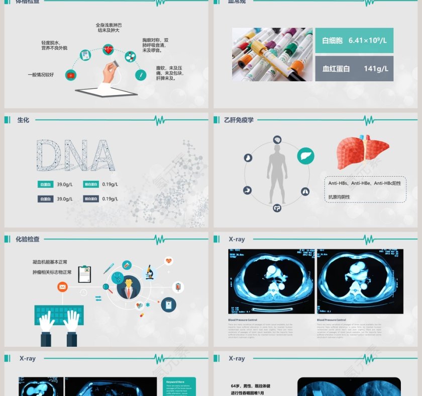 医院病例汇报PPT模板第2张