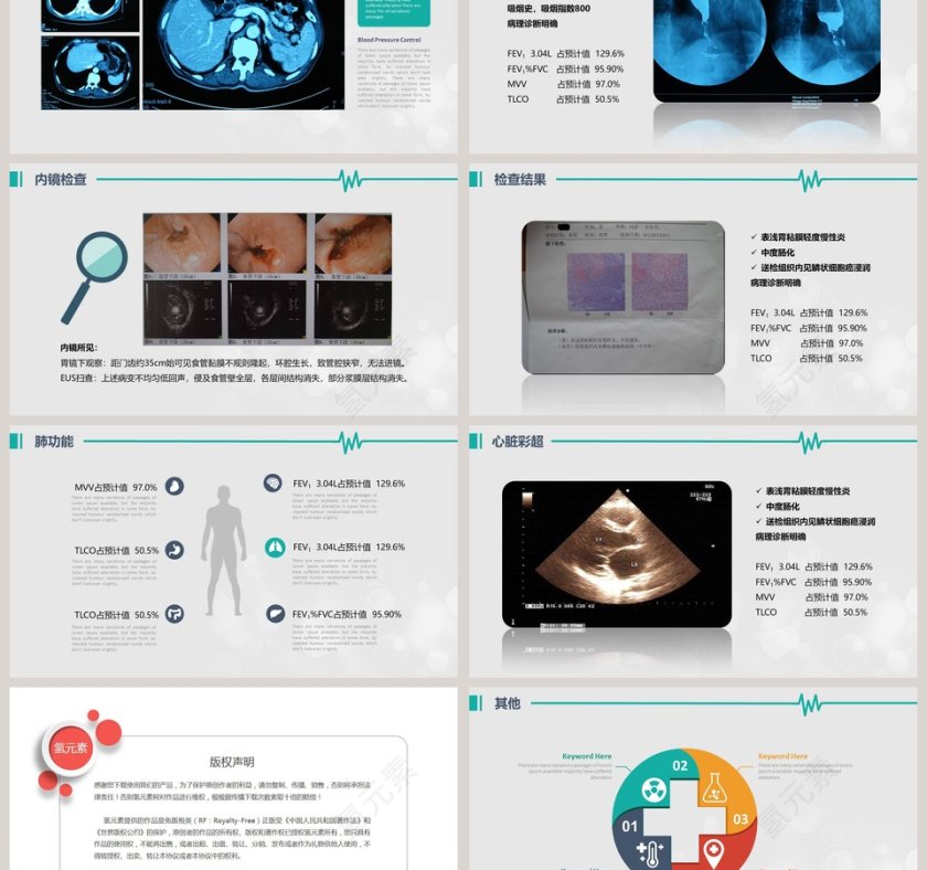 医院病例汇报PPT模板第3张