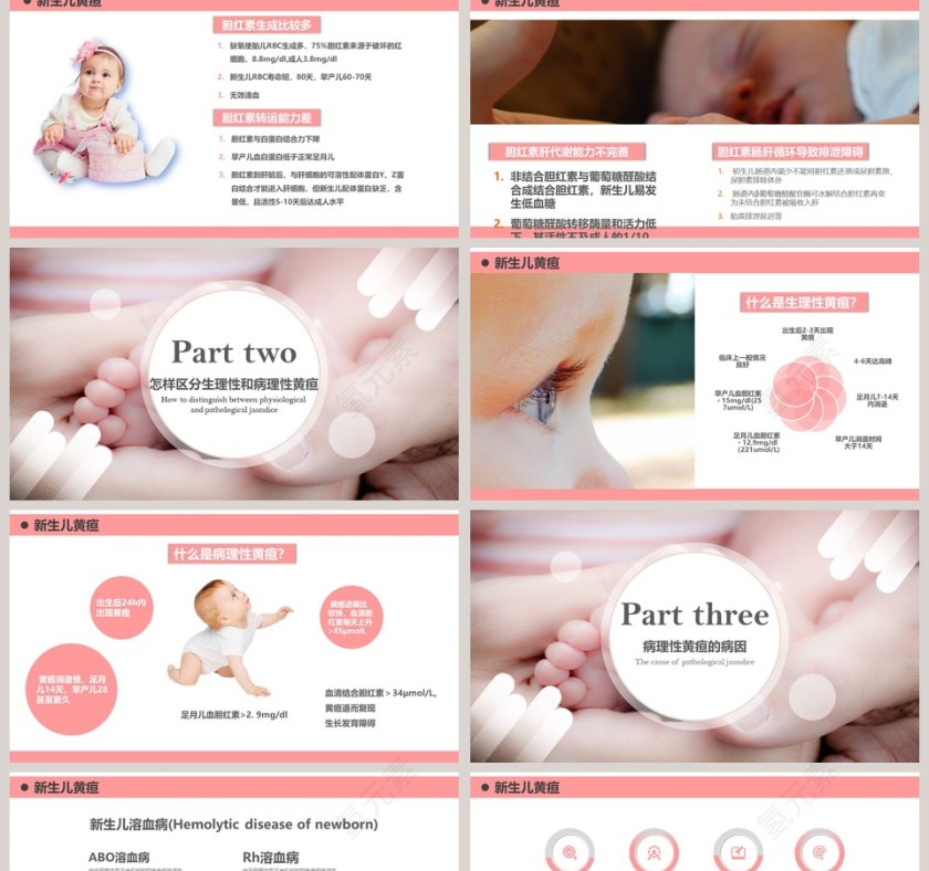 新生儿黄疸健康教育宣传ppt第2张