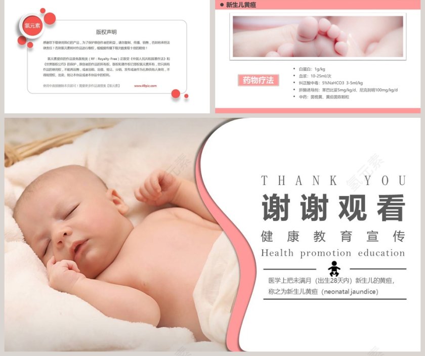 新生儿黄疸健康教育宣传ppt第5张