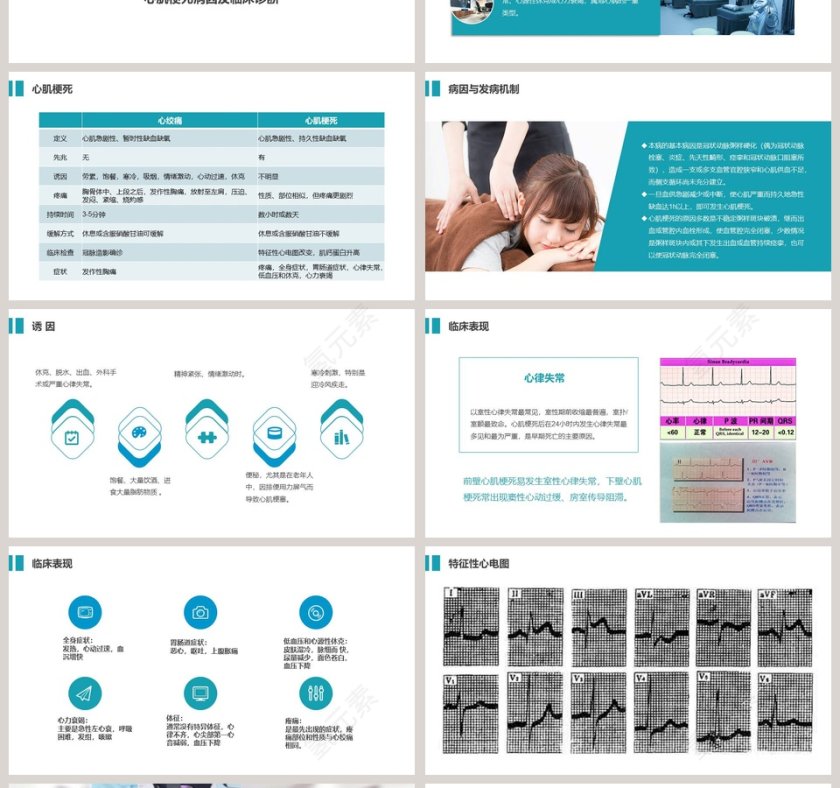 精美大气急性心梗护理查房PPT第4张