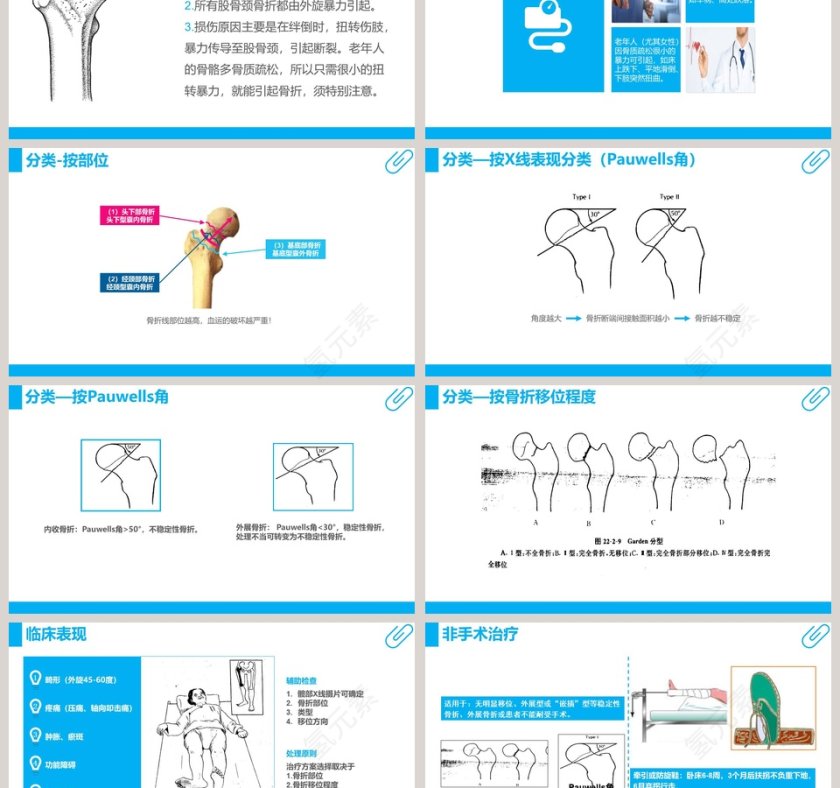 股骨颈骨折护理查房ppt 第3张