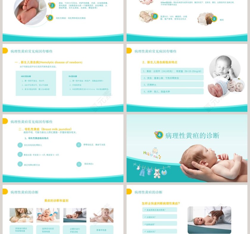 卡通医疗新生儿黄疸治疗护理知识PPT第3张