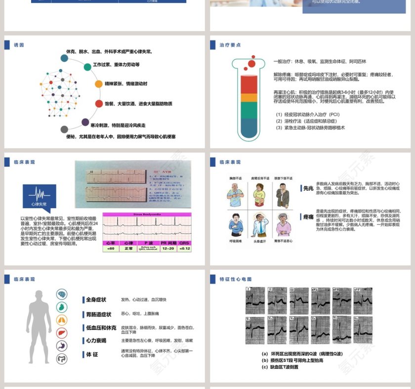 急性心肌梗死护理查房PPT第4张