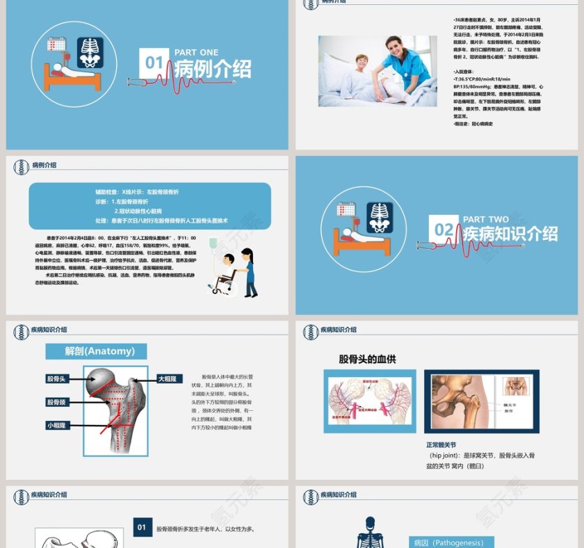 卡通简约风医学股骨颈骨折护理查房PPT第2张