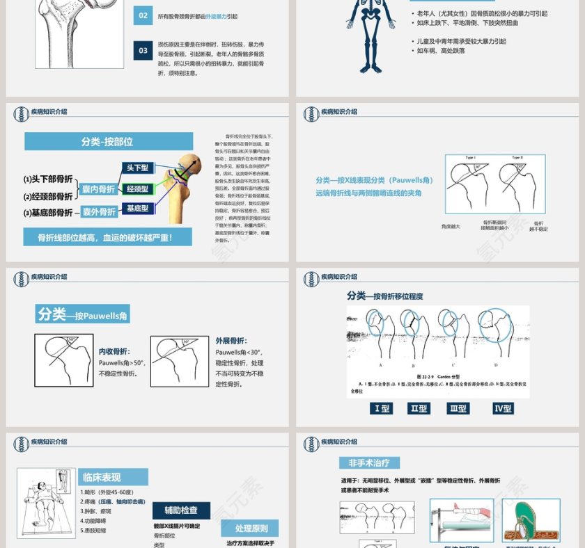 卡通简约风医学股骨颈骨折护理查房PPT第3张