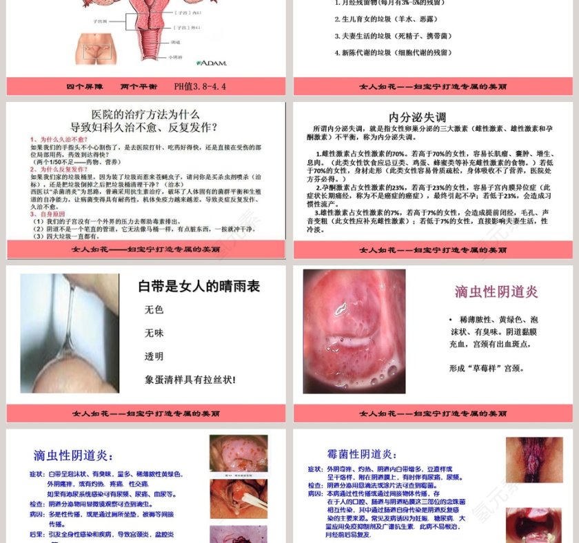 妇科疾病知识讲座PPT模板第3张