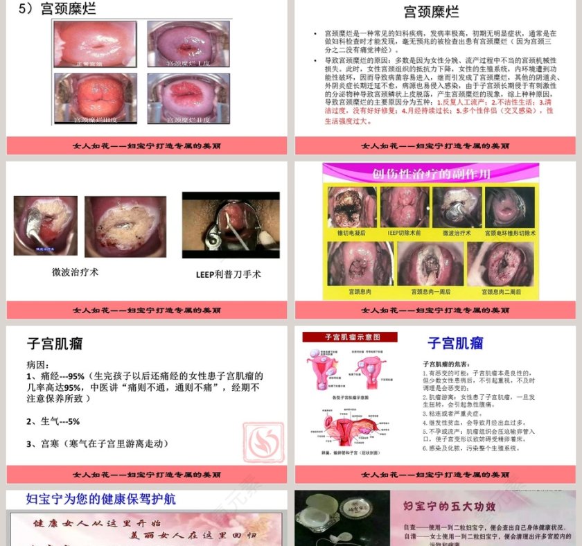 妇科疾病知识讲座PPT模板第5张