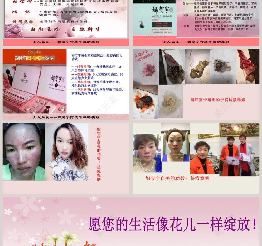 妇科疾病知识讲座PPT模板第6张