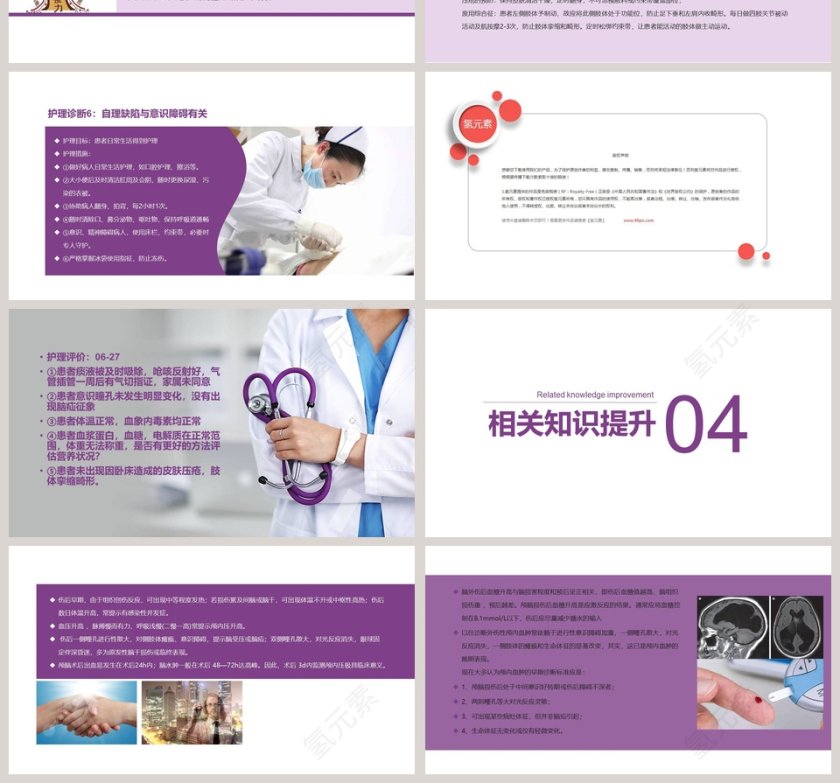 实用大气颅脑外伤护理查房PPT第4张