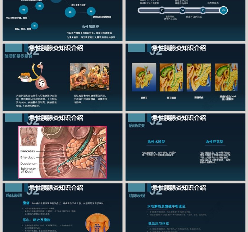 急性胰腺炎病人的护理课件ppt模板第3张