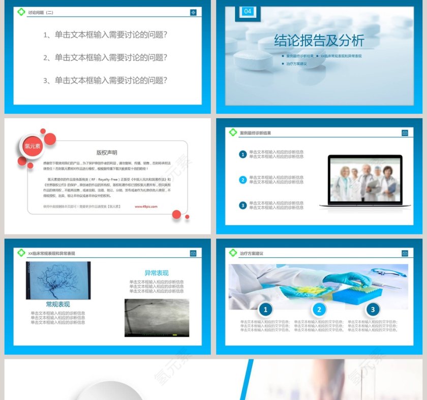 简约清新病例讨论PPT模板第5张