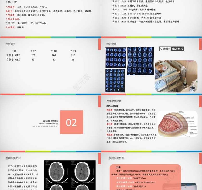 亚急性硬膜下血肿护理查房PPT 第2张