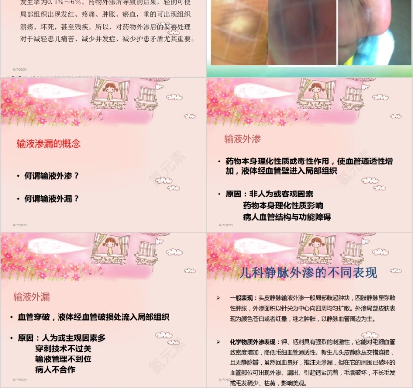 新生儿输液渗漏后的护理对策PPT第2张