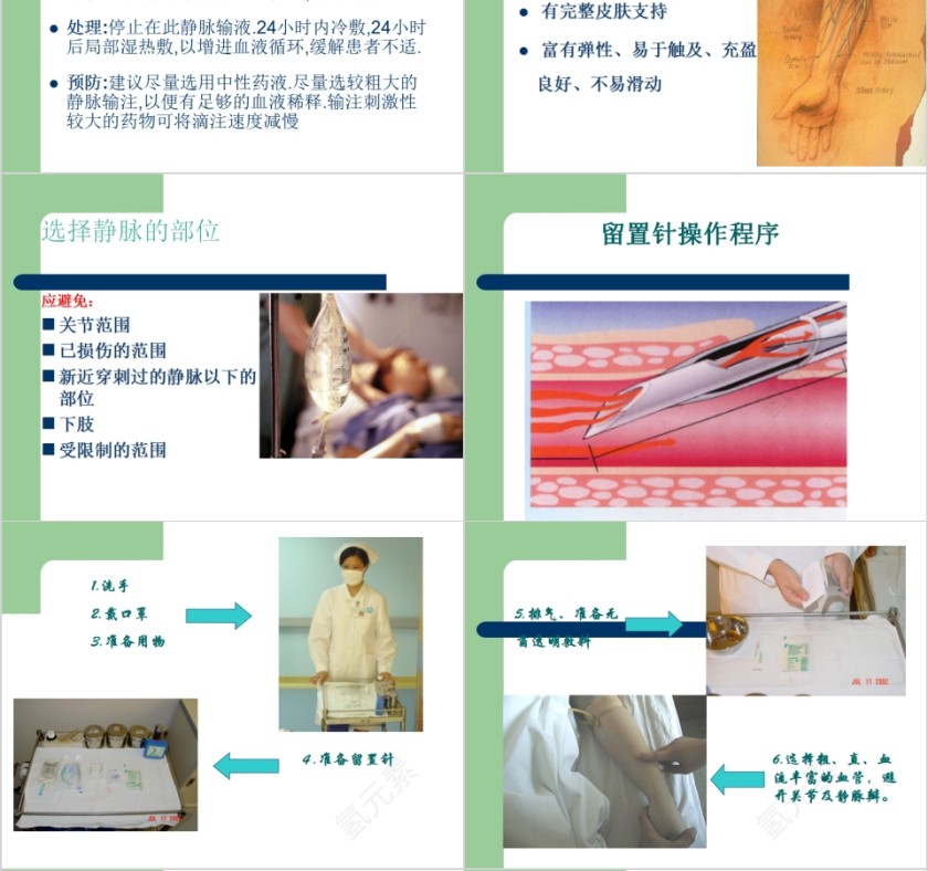 简约清新静脉输液知识培训PPT模板第4张