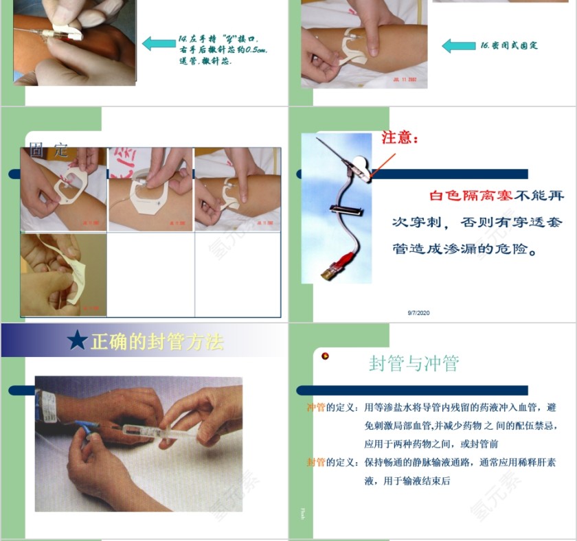 简约清新静脉输液知识培训PPT模板第6张