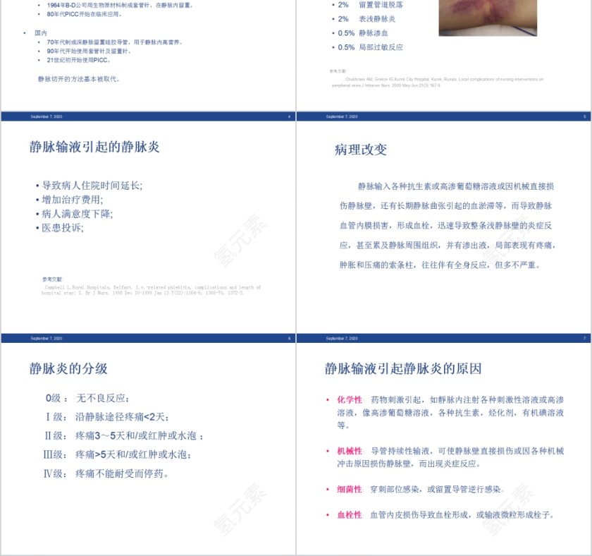 静脉输液的血管保护和周围皮肤护理PPT模板第2张