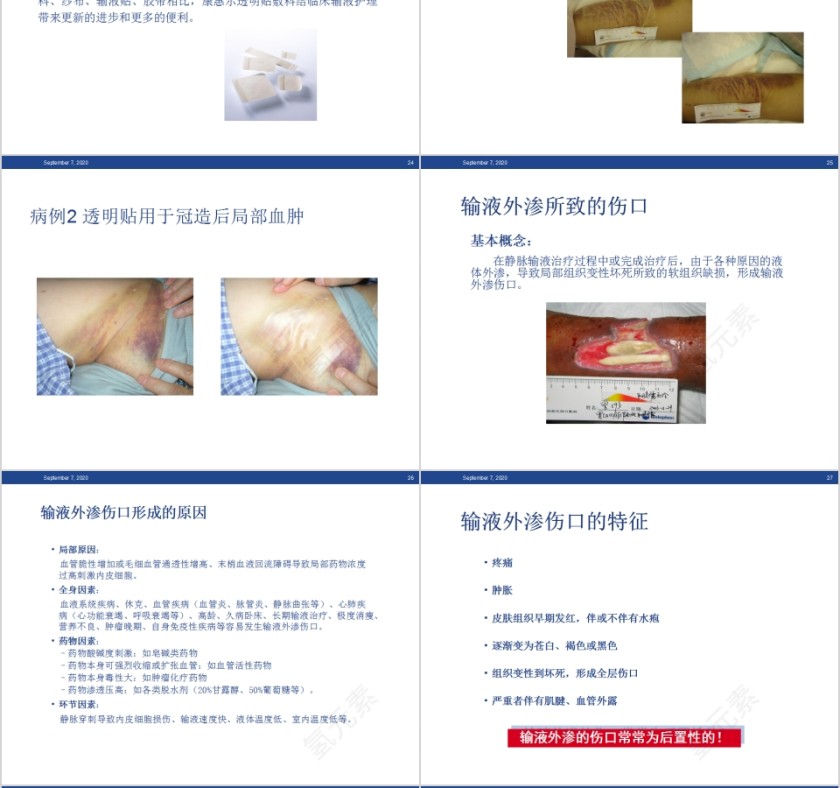 静脉输液的血管保护和周围皮肤护理PPT模板第6张