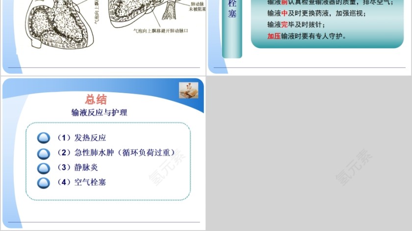 静脉输液医疗培训PPT模板第6张