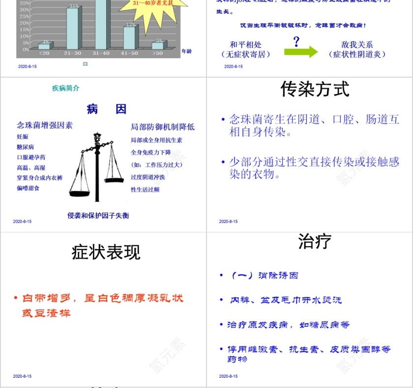 简约妇科疾病知识培训PPT第4张