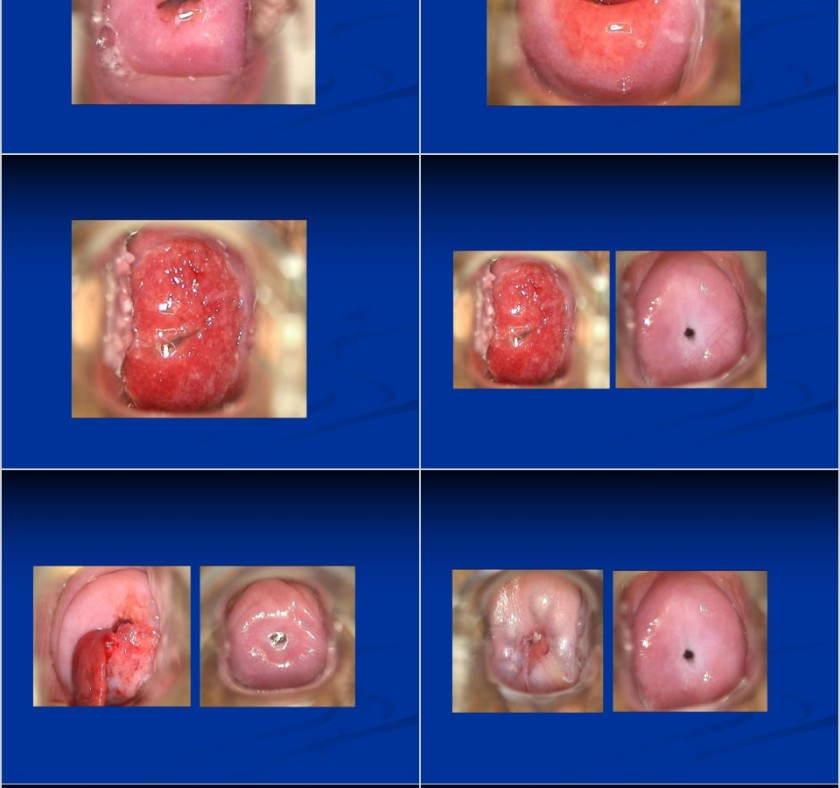 女人有健康家庭更幸福妇科常见疾病知识讲座PPT第8张
