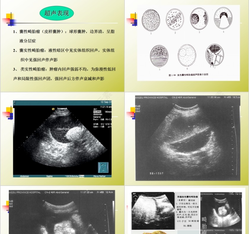 简约清新妇科常见疾病知识PPT模板第11张