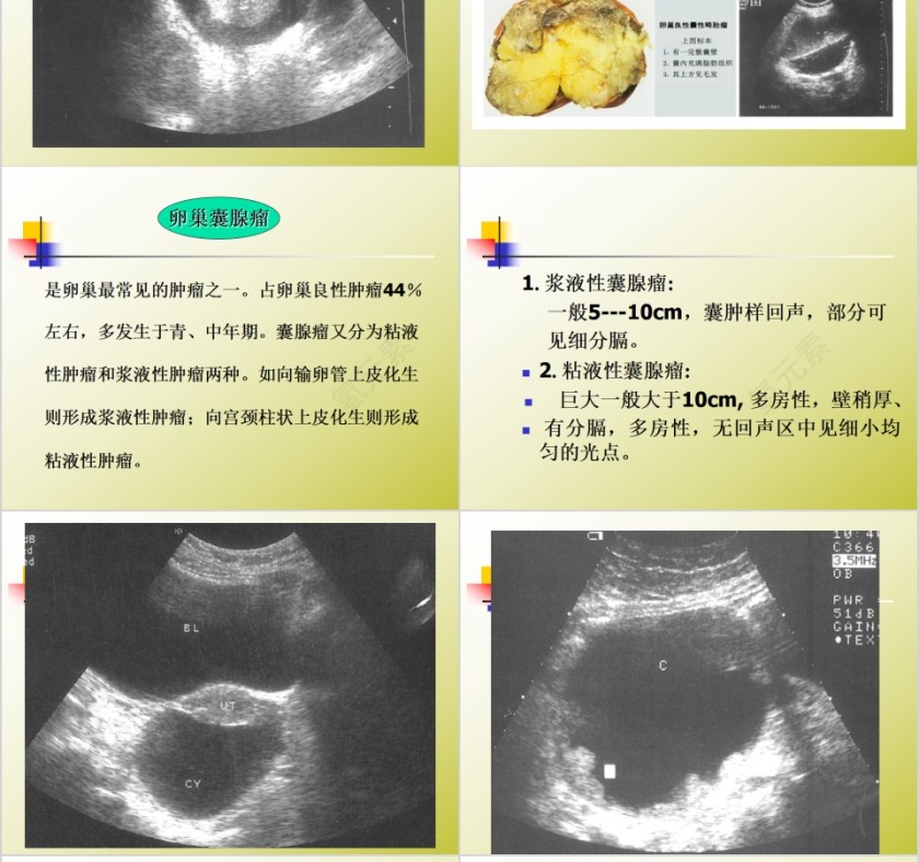 简约清新妇科常见疾病知识PPT模板第12张