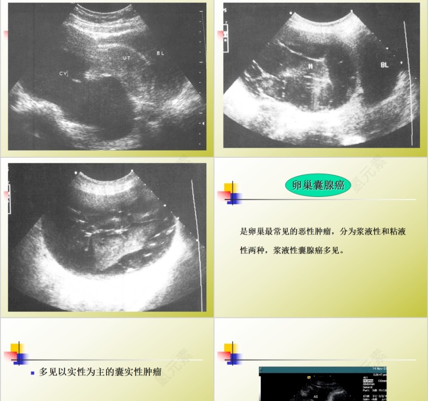 简约清新妇科常见疾病知识PPT模板第13张