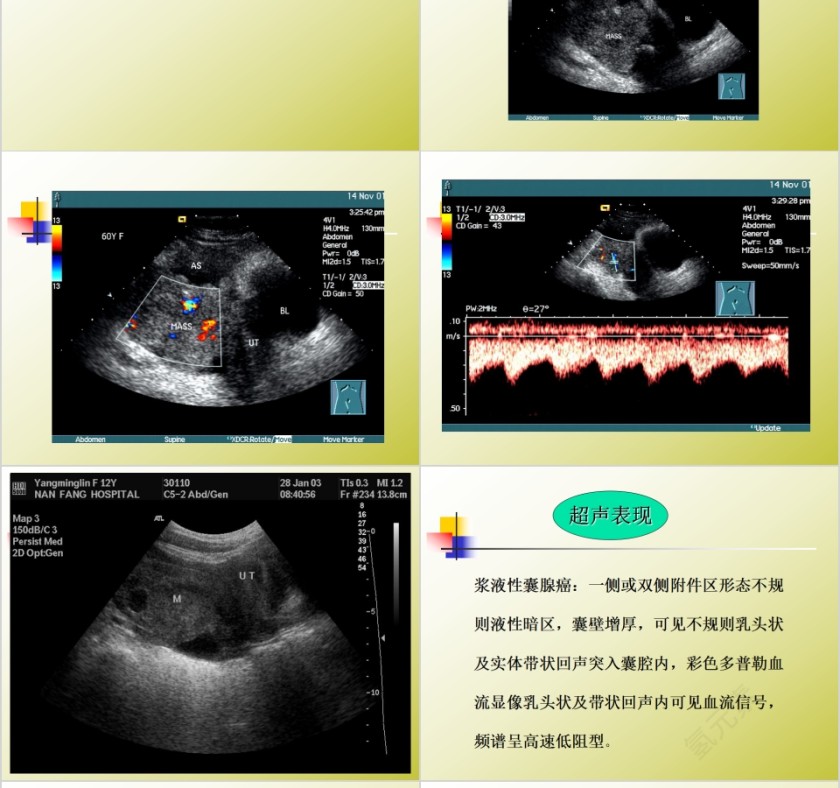 简约清新妇科常见疾病知识PPT模板第14张