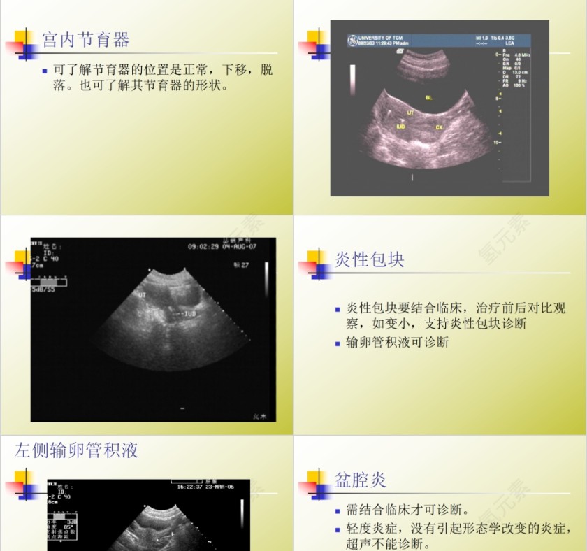 简约清新妇科常见疾病知识PPT模板第15张