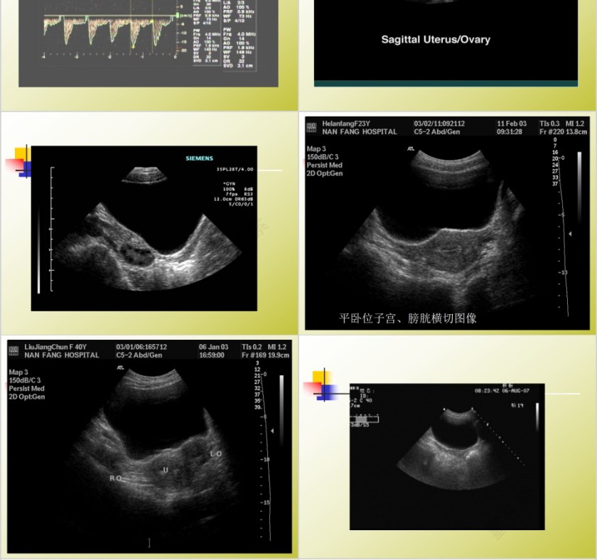 简约清新妇科常见疾病知识PPT模板第4张