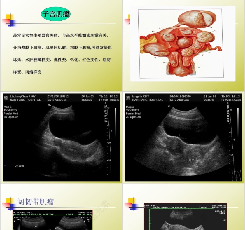 简约清新妇科常见疾病知识PPT模板第5张