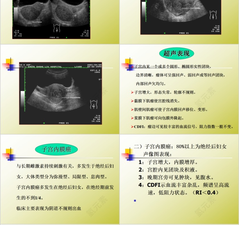 简约清新妇科常见疾病知识PPT模板第6张