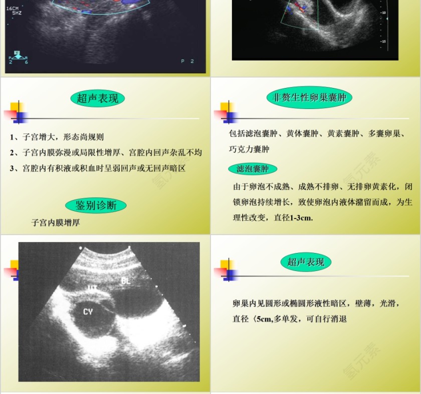 简约清新妇科常见疾病知识PPT模板第8张