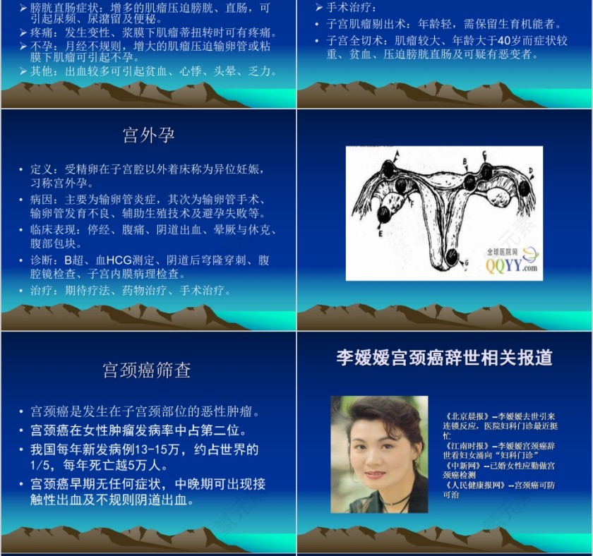 简约商务妇科常见病知识讲座PPT第8张