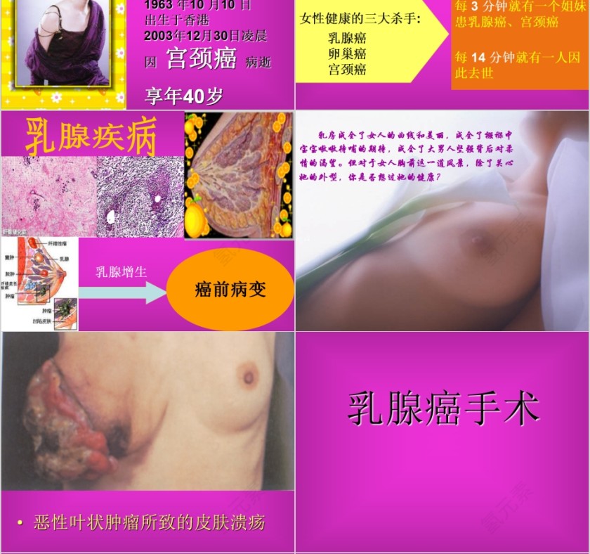 红色简约妇科疾病知识PPT模板第4张