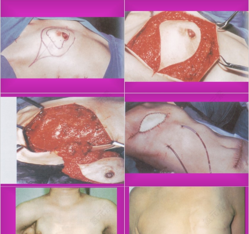 红色简约妇科疾病知识PPT模板第5张