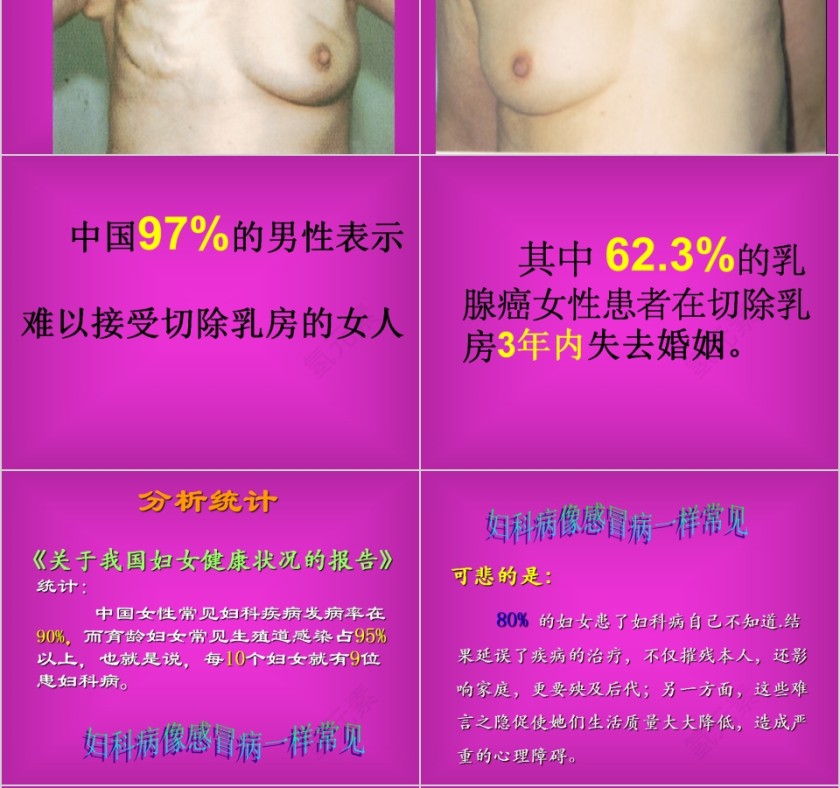 红色简约妇科疾病知识PPT模板第6张