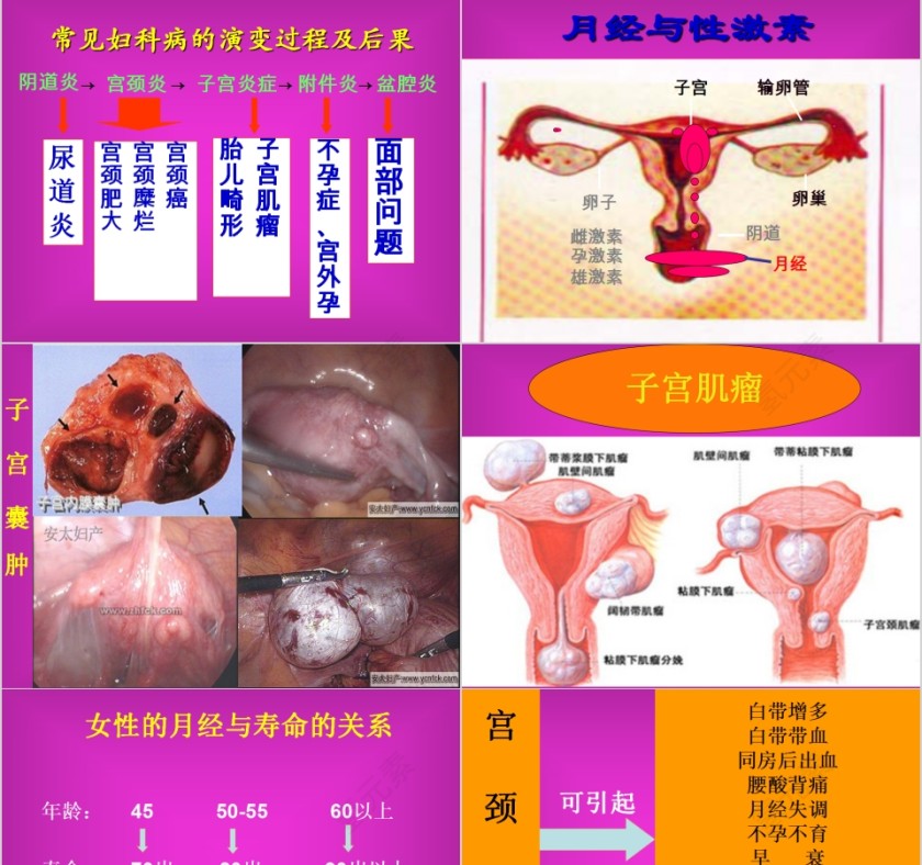 红色简约妇科疾病知识PPT模板第7张