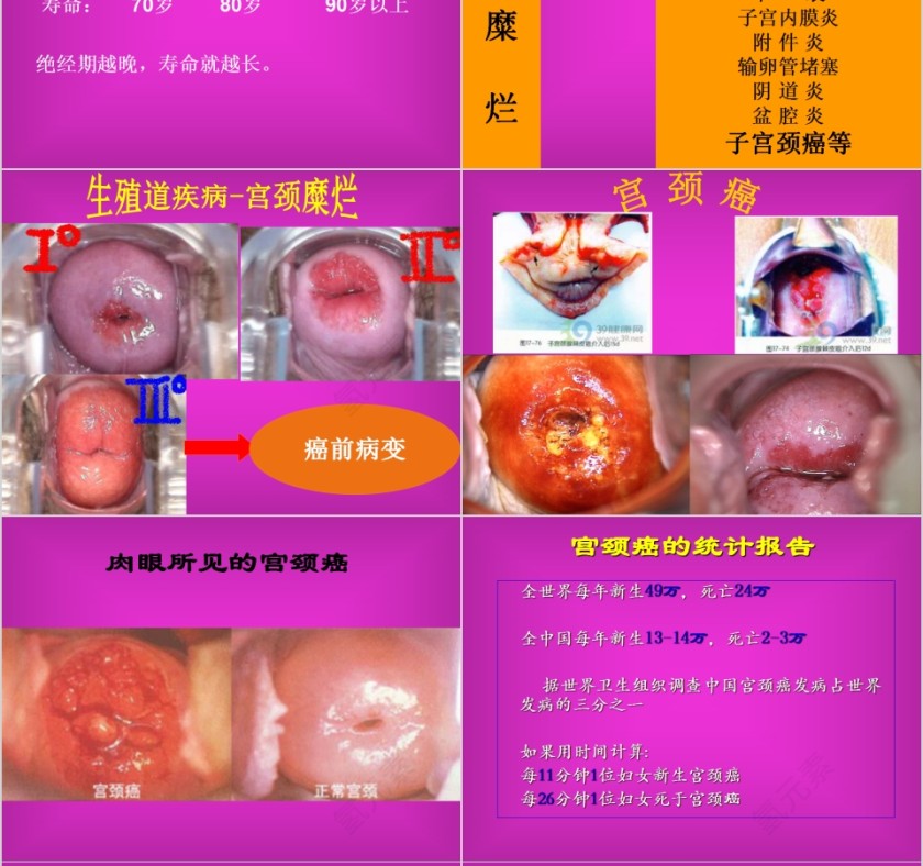 红色简约妇科疾病知识PPT模板第8张