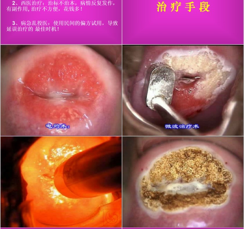 红色简约妇科疾病知识PPT模板第10张